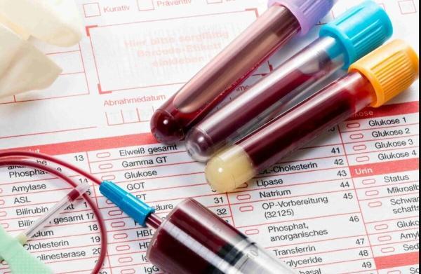 آزمایش گاز خون چیست و برای چه کاری استفاده می گردد؟