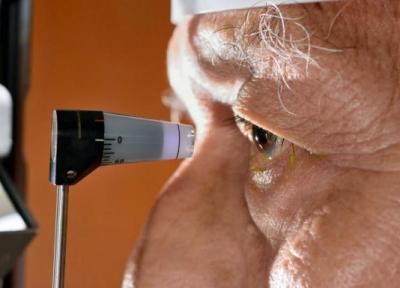 روش تازه ژن درمانی، فشار چشم را برای درمان گلوکوم کاهش می دهد