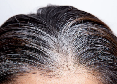 کشف راهی برای جلوگیری از سفید شدن مو ها